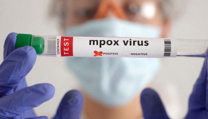 2024-08-20t140130z_1463373049_rc2pj9a34q6t_rtrmadp_3_health-mpox.jpg 2024-08-20t140130z_1463373049_rc2pj9a34q6t_rtrmadp_3_health-mpox.jpg