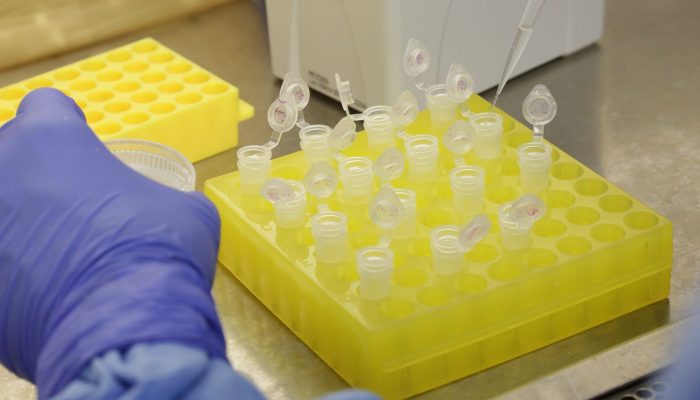 diagnostico_laboratorial_de_casos_suspeitos_do_novo_coronavirus_2801209411.jpg