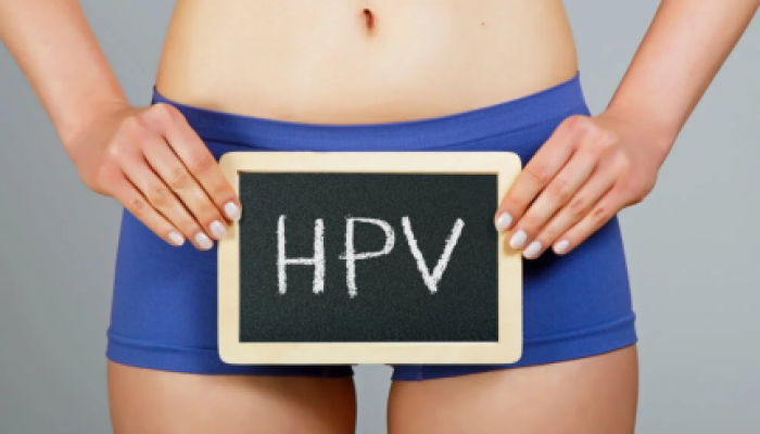foto-hpv-especialista-explica-quais-sao-os-sintomas-tratamento-e-como-evitar-a-doenca-430x289.png