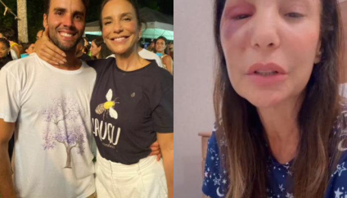 foto-leo-dias-2026-03-02T222720.802-430x323.png