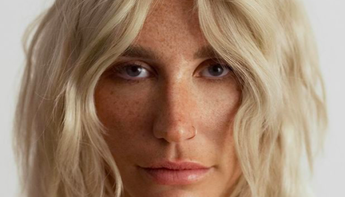 kesha-revela-quase-morreu-apos-congelar-ovulos-e1687306244240.png
