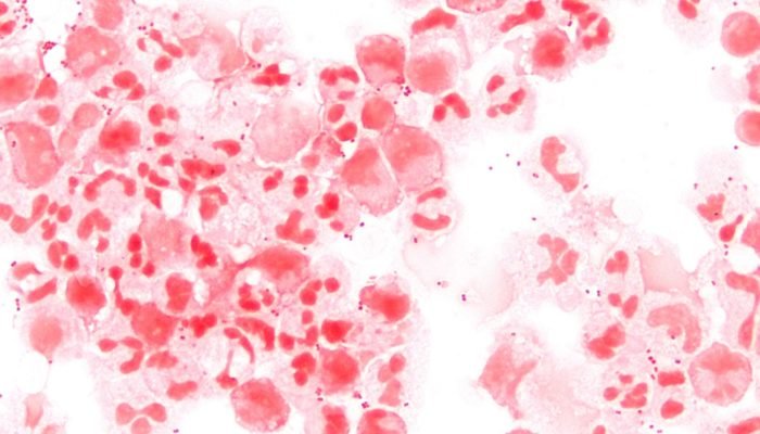 neisseria-meningitidis-csf-gram-1000.jpg