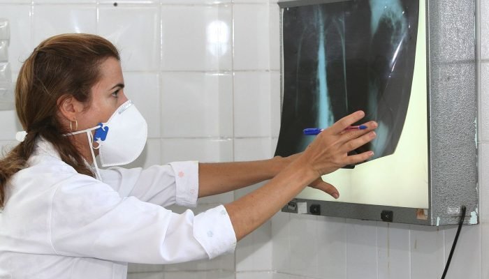 tuberculose.jpg